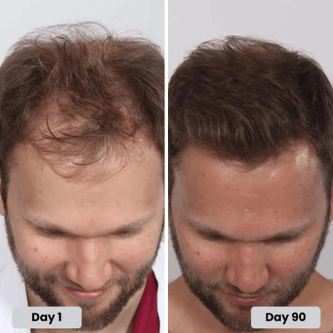 TrichoGlow Red Light Therapy Cap for Hair Growth Support - View 6