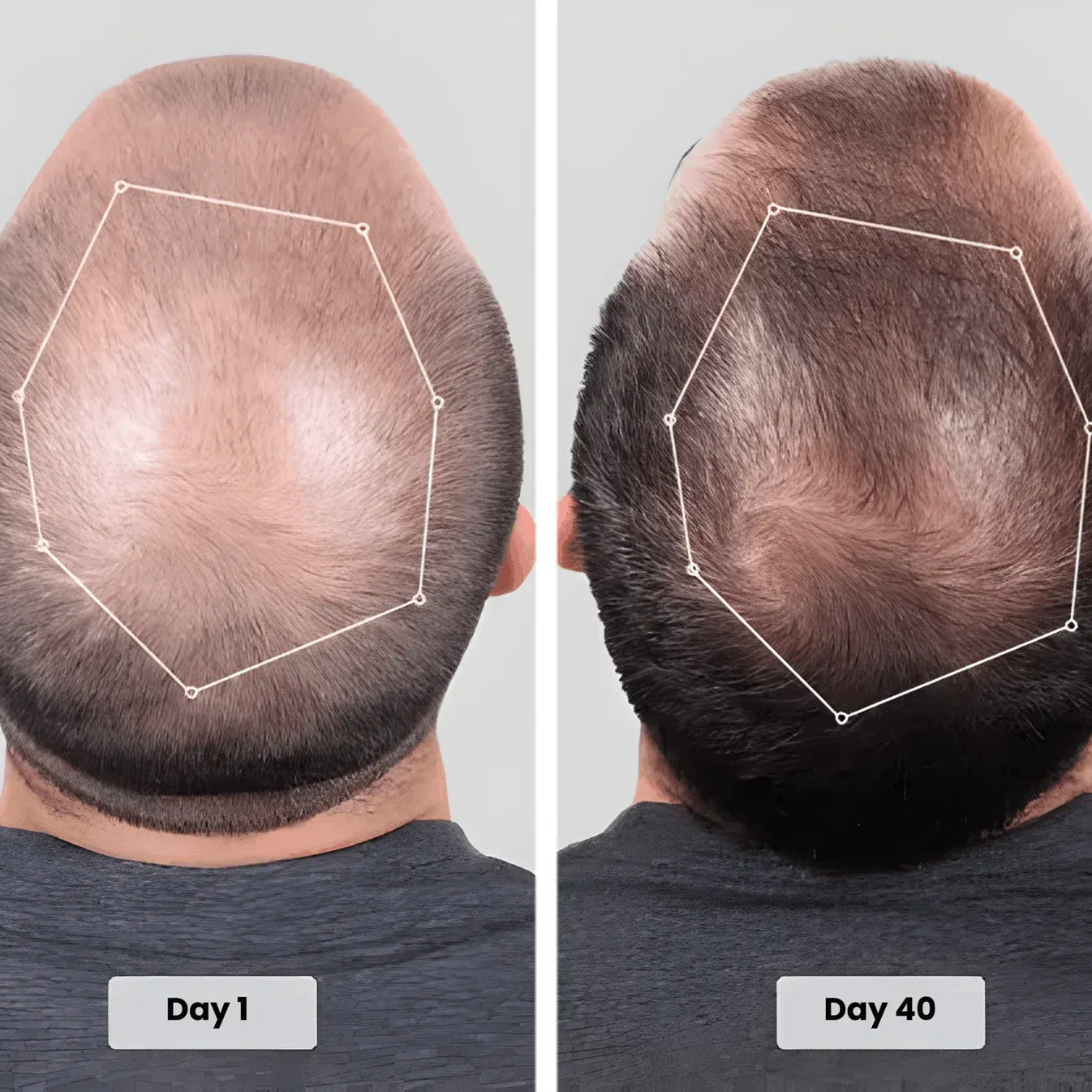 Customer crown progress from day 1 to day 40