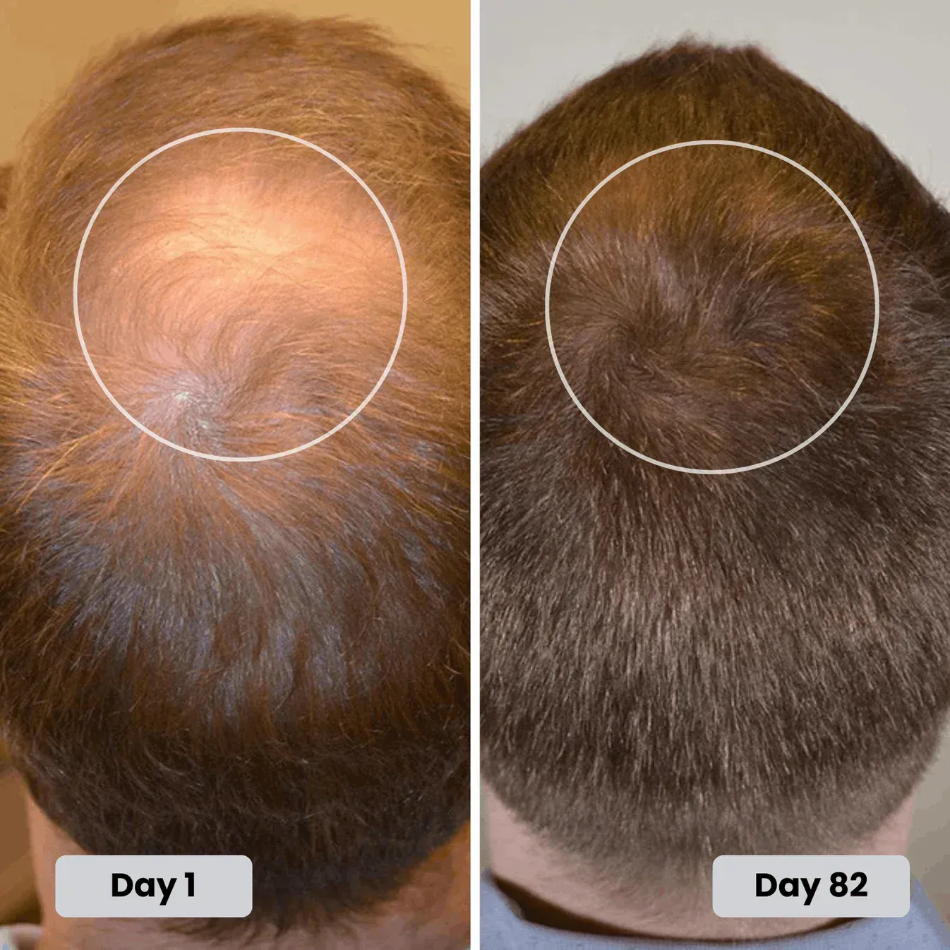 Customer crown progress from day 1 to day 82