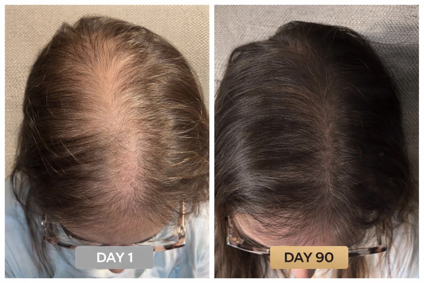 Day 1 and Day 90 crown coverage progress